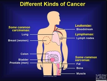 มะเร็งคืออะไร