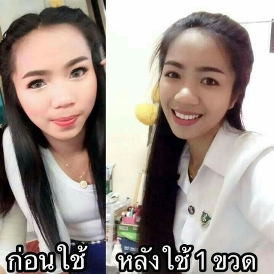 รีวิว ยาปลูกผม ผู้หญิง