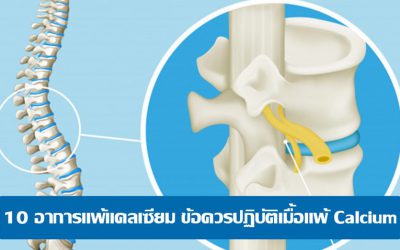 10 อาการแพ้แคลเซียม ข้อควรปฏิบัติเมื้อแพ้ Calcium